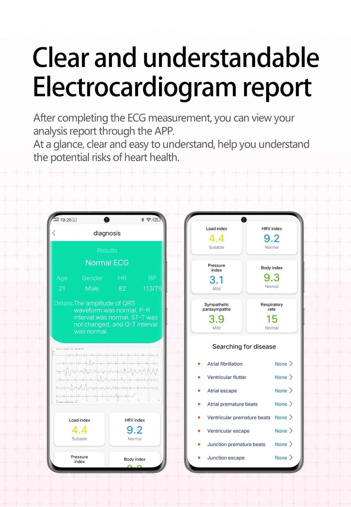 HUAWEI S17 Air Bag Smartwatch – 2.06” AMOLED HD | ECG + PPG | True Blood Pressure, Blood Fat SpO2 Monitor | NFC + Bluetooth Call