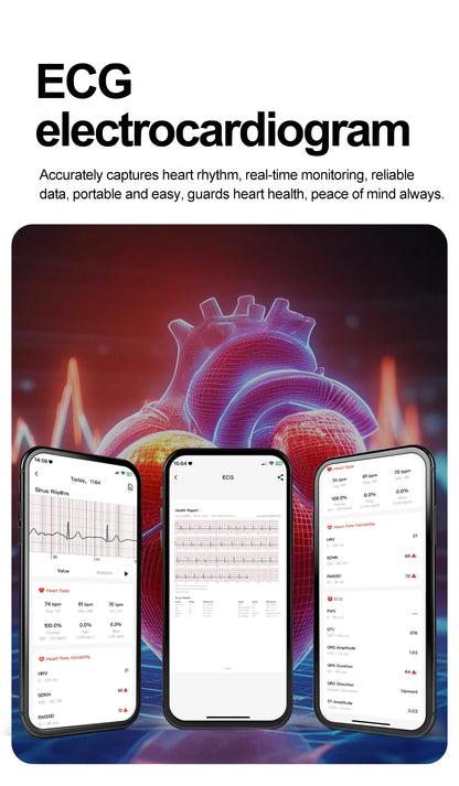 ECG+PPG Smart Watch | Uric Acid & Blood Pressure Tracker - TREASURE ESHOP