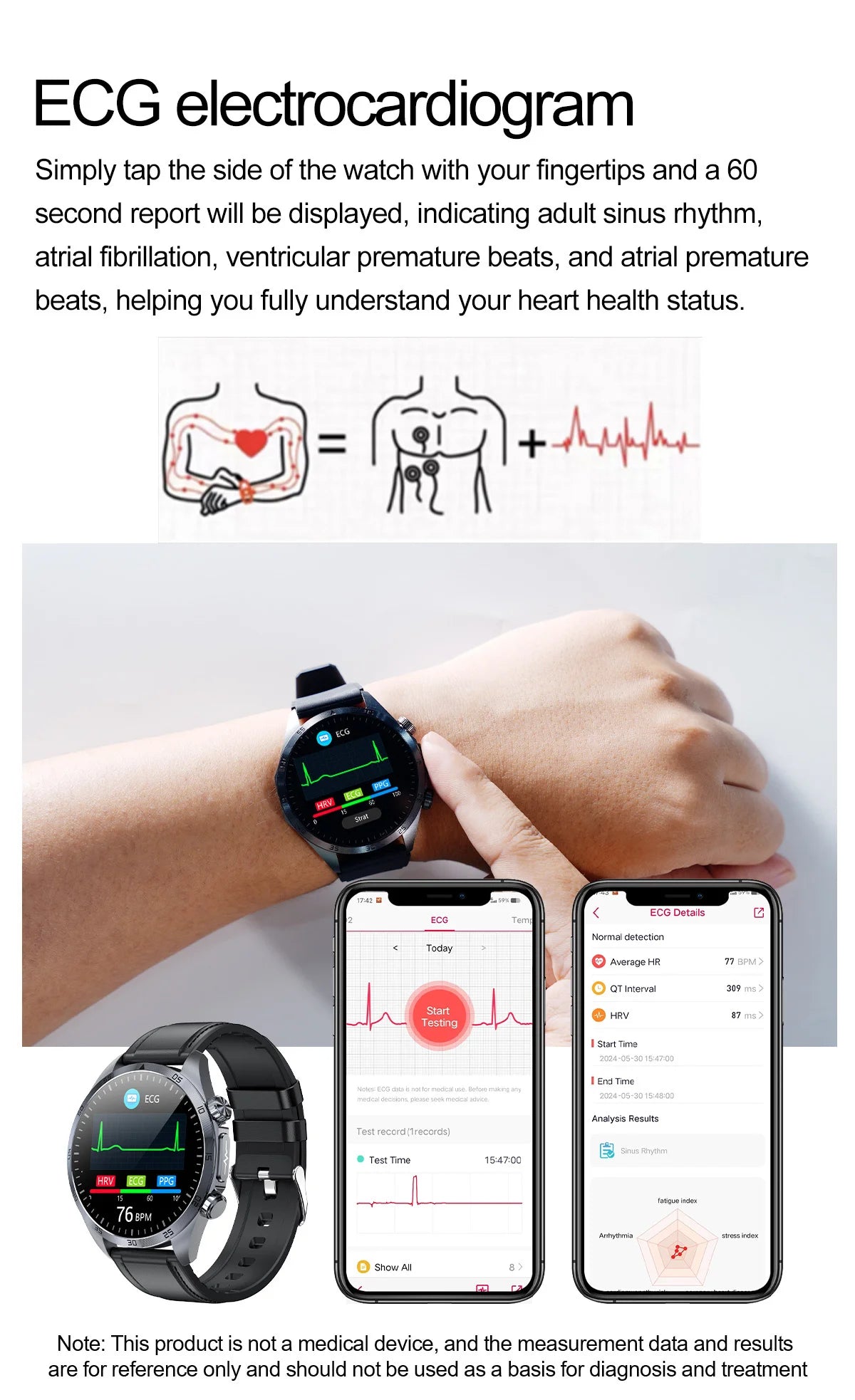ECG+PPG Smart Health Watch | AI Blood Lipid & Fitness Tracker - TREASURE ESHOP