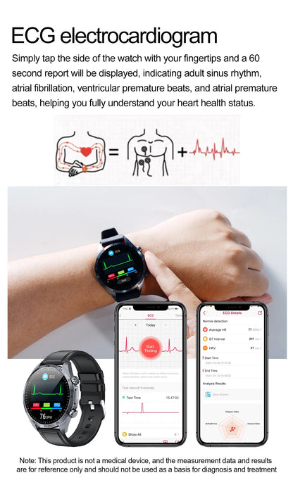 ECG+PPG Smart Health Watch | AI Blood Lipid & Fitness Tracker - TREASURE ESHOP