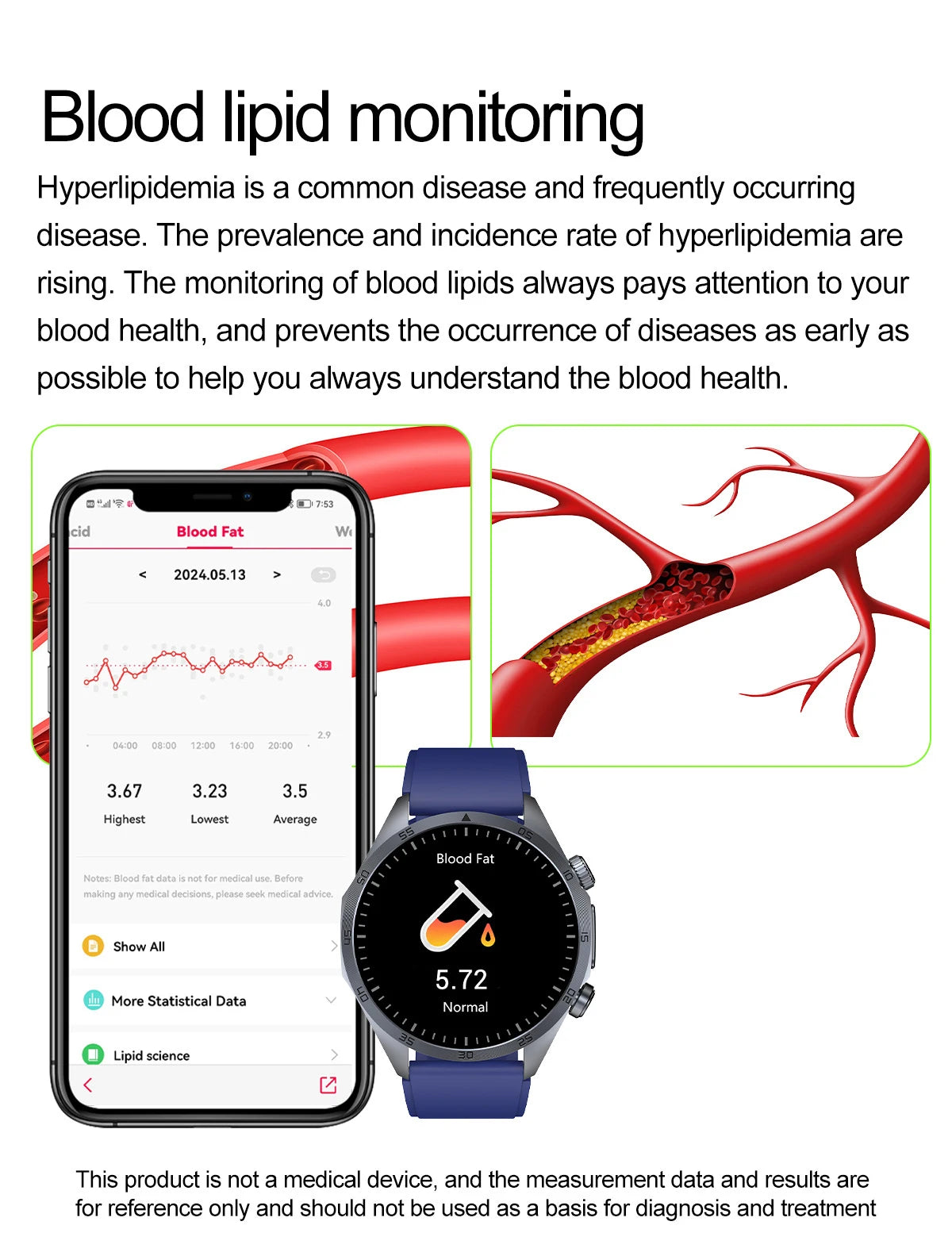 ECG+PPG Smart Health Watch | AI Blood Lipid & Fitness Tracker - TREASURE ESHOP
